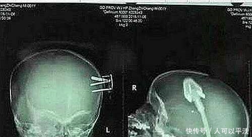 仲夏夜之夢 视频截图